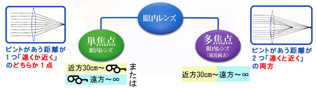 みなと眼科クリニック 眼内レンズの種類