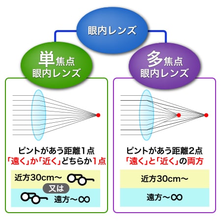 みなと眼科クリニック 眼内レンズの種類